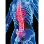 Compact Spinal Brace-حزام تقويم الظهر - Image 2